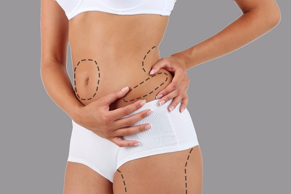 Major Facts to Know About Liposuction